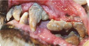 Severe Dental Disease with Gingiviits